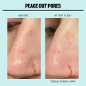 Peace Out Oil-Absorbing Pore Treatment Strips