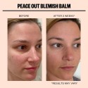 Peace Out Blemish Balm Cleanser