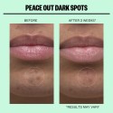 Peace Out Dark Spots Microneedling Dark Spot Brightening Dots