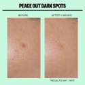 Peace Out Dark Spots Microneedling Dark Spot Brightening Dots