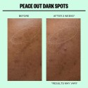 Peace Out Dark Spots Microneedling Dark Spot Brightening Dots