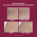 Peter Thomas Roth Even Smoother Glycolic Retinol Resurfacing Serum