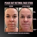 Peace Out Retinol Face Stick