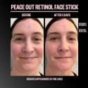 Peace Out Retinol Face Stick