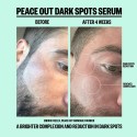 Peace Out Dark Spots Serum