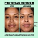 Peace Out Dark Spots Serum