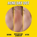 Peace Out Acne Salicylic Acid Day & Night Duo