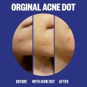 Peace Out Acne Salicylic Acid Day & Night Duo