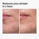 The Ordinary Sulfur 10% Powder-to-Cream Concentrate Acne Spot Treatment
