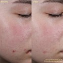 Byoma Blemish Clearing Paste
