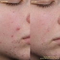 Byoma Blemish Clearing Cleanser