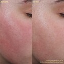 Byoma Redness Relief Soothing Toner