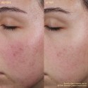 Byoma Blemish Control Moisturizer