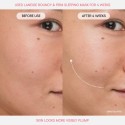 Laneige Mini Bouncy & Firm Skin Treats