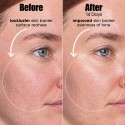 Sunday Riley A.I. Adaptive Retinoid Serum For Blemish Prone Skin