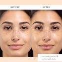 Patchology Skin Remedy Calm & Protect Mist