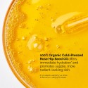 The Ordinary 100% Organic Cold-Pressed Rose Hip Seed Oil for Skin Elascicity