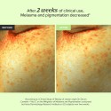 Beauty of Joseon Light On Vitamin C Serum For Brightening & Dark Spot Correction