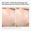 The Ordinary Rice Lipids + Ectoin Microemulsion Moisturizer for Soothing Hydration & Reduced Redness