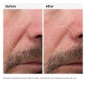 The Ordinary 100% Fermented Rose Hip Seed Oil