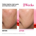 Anua Niacinamide 10 + TXA 4 Serum
