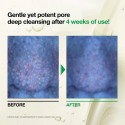 Anua Heartleaf Pore Control Cleansing Oil