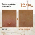 Anua Rice 70 Glow Milky Toner