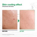 Anua Heartleaf 77 Soothing Toner