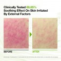 Anua Azelaic 10 Hyaluron Redness Soothing Pad