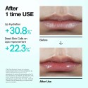Anua PDRN Lip Serum