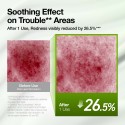 Anua Azelaic Acid 3 Cica Skin Soothing Moisturiser