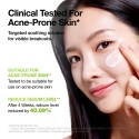 Anua Azelaic Acid 3 Cica Skin Soothing Moisturiser