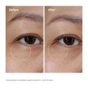 The Ordinary Lacto-PDRN* 4% + B9 Eye Cream