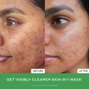 Ole Henriksen Mighty Minis Set